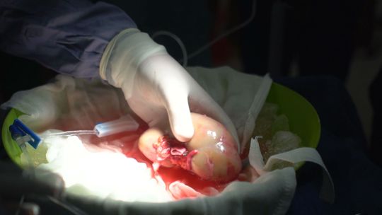 Ogólnopolski Dzień Transplantacji