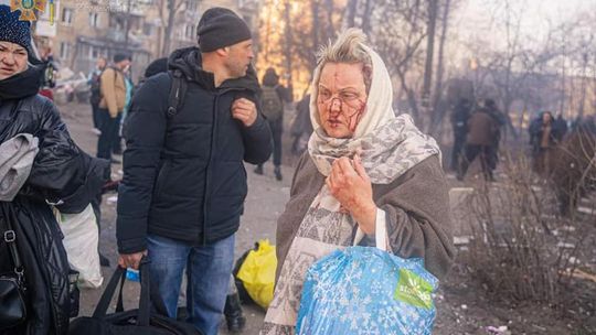 Putin przekroczył w Ukrainie nie jedną granicę. Używa broni, która spala człowieka [ARTYKUŁ]