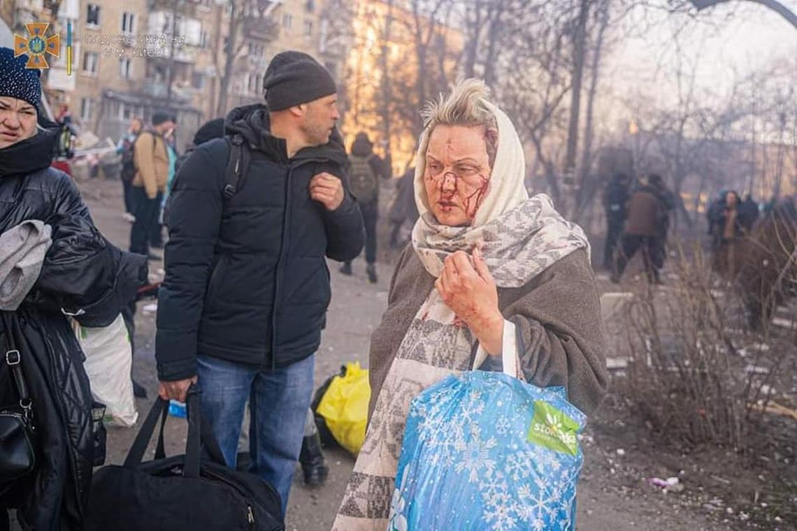 Putin przekroczył w Ukrainie nie jedną granicę. Używa broni, która spala człowieka [ARTYKUŁ]